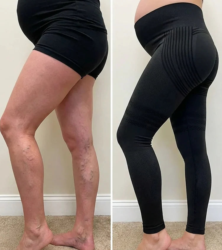 Vindrax 3D Sculpting Leggings, lindring vid åderbråck